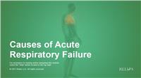 Causes of Acute Respiratory Failure